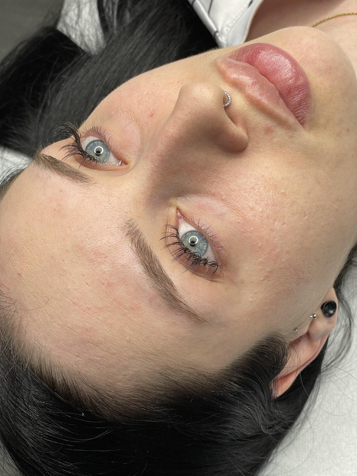 Before and after result of a brow treatment 5
